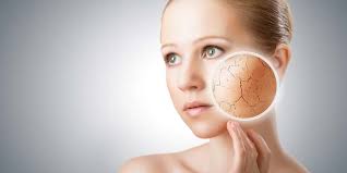 Why it happens & simple home remedies. Best Home Remedies For Dry Skin Belleness Maven Diy