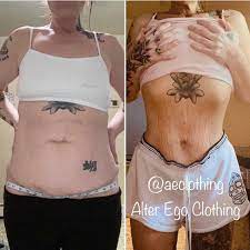 Alter Ego Clothing Waist Training Results After 1 Month Using Aeclothing Waist Waisttrainer Waisttraining Waisttrainers Waisttrainingbeforeandafter Snatchedwaist Corsetry Results Beforeandafter Waisttraining101 Alteregoclothing Facebook