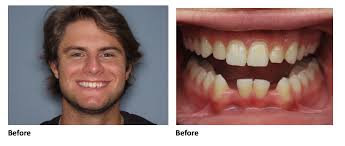 Patient Stories Archives