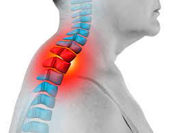 They may lead to a puffy, rounded face and the characteristic hump of fatty tissue at the base of the neck. Hump At The Base Of Your Neck