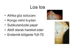 Filaryalar Ipliksi Uzun Nematodlar Lenf Dolasim Sistemi Deri Ppt Indir