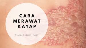 Aug 20, 2009 · di sini saya cuba paparkan beberapa jenis gambar kayak hasil kefahaman saya. Cara Merawat Kayap Dengan Lebih Berkesan Dan Selamat Suplemen Shaklee Untuk Kayap Ziana Eunos