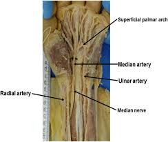 V p nathan & partners. Recently Increased Prevalence Of The Human Median Artery Of The Forearm A Microevolutionary Change Lucas 2020 Journal Of Anatomy Wiley Online Library