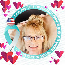Scleroderma warrior and foundation co-founder passes away