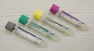 Qtbg qft3 86480 86480 no june 9, 2016. Tb Quantiferon Gold Test Mycobacteria Mycobacterium Tuberculosis Mtb Latent Igra Gamma Interferon
