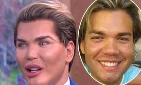 12.10.2021 · she eventually came clean about getting plastic surgery. Human Ken Doll Rodrigo Alves Isn T Addicted To Surgery Daily Mail Online