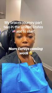 My Braces Journey: Part Two in the Dental Office