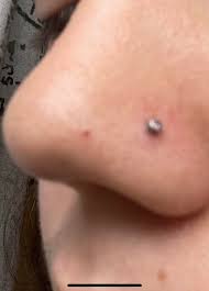 Nose Piercing Swelling Legitpiercing