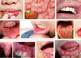 Pin Di Propolisdangamat Strikingly