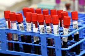 Video Growing Number Of Canadians Plan To Get Vaccinated For Covid 19 Lake Country Calendar