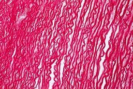 Our objective is to appraise the state of the art concerning this polysaccharide: 3 367 Human Tendon Photos Free Royalty Free Stock Photos From Dreamstime