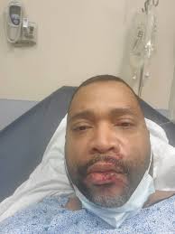 How long after a fall should you get back