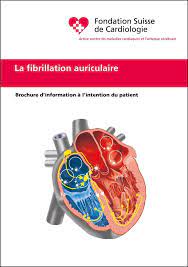 La fibrillation auriculaire ou fibrillation atriale est le trouble cardiaque le plus fréquent, surtout après 60 ans. La Fibrillation Auriculaire Fondation Suisse De Cardiologie