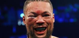 Locura en Londres: Zhang castiga a Joyce, le cierra un ojo y le arrebata su  título interino