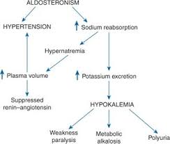Image result for Hyperaldosteronism