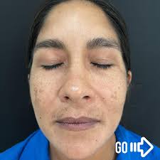 Zoë Bernard (Arscott), HOLISTIC SKIN EXPERT