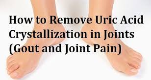 Pin On Home Remedies