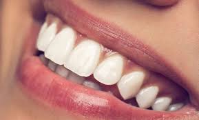 Best Teeth Whitening Treatment in Pune | Jehangir OraCare