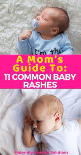 Animationideas Babycaretips Destinationwedding Homeschoolingideas In 2020 Baby Rash Newborn Rash Baby Supplies