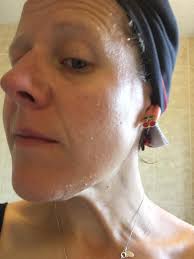 Peel looking perfect this morning