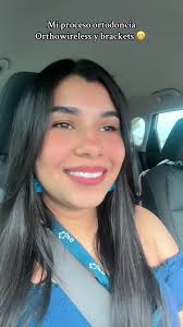 Ni se notan arriba cierto? @OrthoWireless 🥲 Ayudame Diosito 😟🤣 #panama  #orthowireless #bracketsmetalicos #ortodonciainvisible #ortodoncia