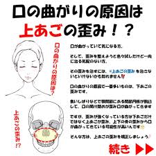 口の曲がりの原因は上あごの歪み 顔やせ 顔の歪み 顔のエクササイズ