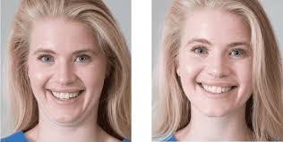 How can i get rid of my double chin? How To Get Rid Of A Double Chin Lose Chin Fat Rooted Mama Health