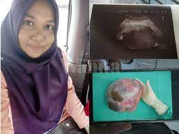 Namun, menurut rakan yang pergi bersamanya, pakar bedah itu kelihatan bingung hampir setengah jam sebelum pembedahan bermula. Ovari Kanan Dibuang Wanita Ini Kongsi Cara Pemulihan Dedah 9 Jenis Makanan Aktifkan Sel Cyst Mingguan Wanita
