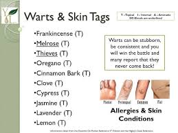 Pin On Essential Oils