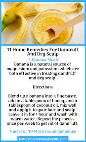 11 Home Remedies For Dandruff And Dry Scalp Home Remedies For Dandruff Dandruff Remedy Dry Scalp