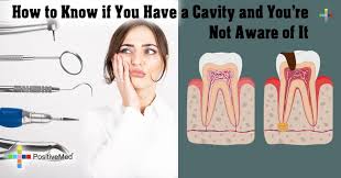 A dental cary, commonly known as a cavity, is a small hole in your tooth caused by tooth decay. How To Know If You Have A Cavity And You Re Not Aware Of It