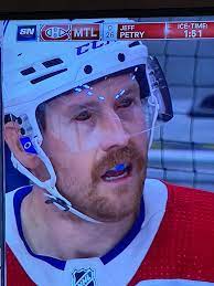 Even though montreal's defenseman has been dealing with a hand injury, his eyes. Rs5ykxkmeabxtm