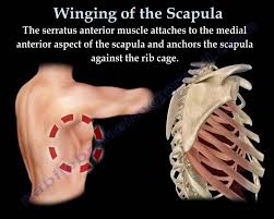 As mentioned above, scapulohumeral rhythm is needed for proper shoulder movements both horizontally and vertically in order to fix your scapular dyskinesis, you'll need to perform exercises to restore proper mobility, stabilize your scapula, retrain. Winging Of The Scapula Long Thoracic Nerve Everything You Need To Kno Scapula Muscle Anatomy Winged Scapula