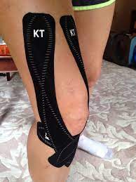 Ensure the knee and surrounding area is shaved and free of body hair. How To Tape A Knee With Kt Tape Yalna