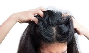 The flavor is slightly different, but the similarities are greater. Does Dandruff Cause Hair Loss The Truths And Treatment Myths Behind Dandruff Samachar Central