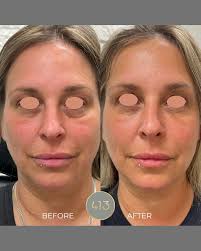 Wishing a very Happy National Physician's Day to our esteemed Medical  Director, Dr. Kelley Wright. Your leadership, expertise, and commitment to  excellence are invaluable to 413 Medical Aesthetics and to the other