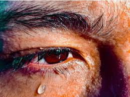 Sweating sickness, also known as the sweats, english sweating sickness, english sweat or sudor anglicus in latin, was a mysterious and contagious disease that struck england and later continental europe in a series of epidemics beginning in 1485. Sweating A Lot Can Be A Sign Of These Health Conditions