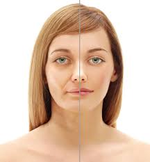 On 05.10 by unknown no comments. Penyakit Bell S Palsy Perawatan Home Care Perawat Home Care Lansia Fisioterapi Terapi Okupasi Dan Terapi Wicara