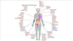 Symptoms of colon cancer include weight loss, bleeding from the rectum, diarrhea and constipation that doesn't go away. Some Lncrnas Associated With Cancers The Colour Represents Either Download Scientific Diagram