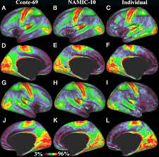 No keys for these older exams, many with units no longer in the math 12 curriculum: Mapping Human Cortical Areas In Vivo Based On Myelin Content As Revealed By T1 And T2 Weighted Mri Journal Of Neuroscience