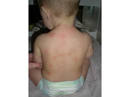 Det er vigtigt at vide, hvornår du skal gå til læge for at søge hjælp. Hvad Kan Det Vaere Diverse Baby Uploadet Af Camilla H