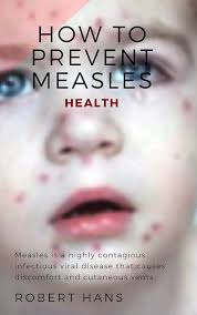 Amazon.com: Health: How to Prevent Measles eBook : HANS, ROBERT: Kindle  Store