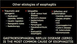 Clinical characteristics and endoscopic features were retrospectively reviewed and categorized. The Radiology Assistant Esophagus I Anatomy Rings Inflammation