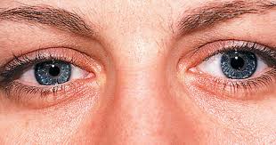 These symptoms can also be caused by more minor eye conditions, so they're not necessarily a sign of cancer. 12 Scary Things Your Eyes Say About Your Health Cbs News
