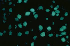 Image result for ANA Staining Pattern