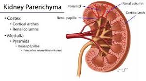 Lesions that characterize renal papillary necrosis come from an impairment of the blood supply and from subsequent ischemic necrosis that is diffuse. Kidney Physiopedia