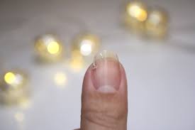 Mais si elle n'a plus mal et cavale, alors tu peux la. Sos Ongle Casse Comment Le Reparer Nail Art By Nails Ink