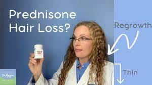 When cortisol is present at high levels it has been demonstrated to reduce the synthesis and. Does Prednisone Cause Hair Loss Dr Megan