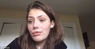 YouTube star Claire Wineland dies from stroke after lung transplant