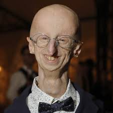 How Sammy Basso's short life changed rare disease research